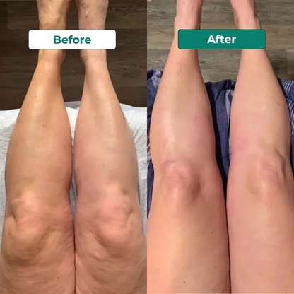 Nutrilyne | 4-Herb Lymphatic Drainage Drops